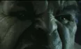 Avatar sero