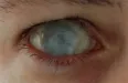 Avatar DeadEyeZero