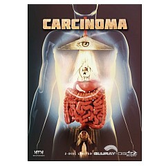 Carcinoma-MTM-Mediabook-Cover-A-AT-Import.jpg