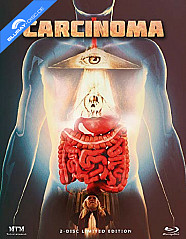 Carcinoma (2014) - Limited Mediabook Edition (Cover A) (Blu-ray + DVD) (AT Import) Blu-ray