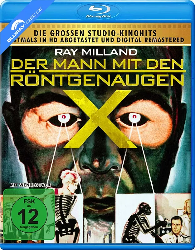 der-mann-mit-den-roentgenaugen-2.-neuauflage-de.webp