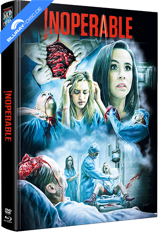 inoperable---aus-diesem-krankenhaus-kommt-niemand-raus-wattierte-limited-mediabook-edition.webp