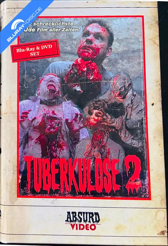tuberkulose-2-limited-hartbox-edition.webp