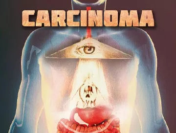 Carcinoma_News.webp