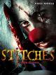 Stitches