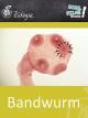 Bandwurm - Schulfilm Biologie