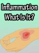 InflammationWhat Is It? [OV]